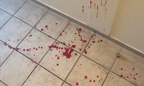 Nur ein kleiner Teil der Verunreinigung. Was passierte hier in einem Hausflur in der Kattowitzer Straße? Foto: Rudolf Karliczek