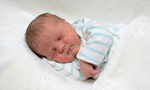 Herzlich Willkommen: Marie Böckmann. Foto: babysmile24.de