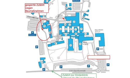 Vom 4. bis zum 8. September führt die Zufahrt zur Kinderklinik über die Sauerbruchstraße. Darstellung: Klinikum Wolfsburg