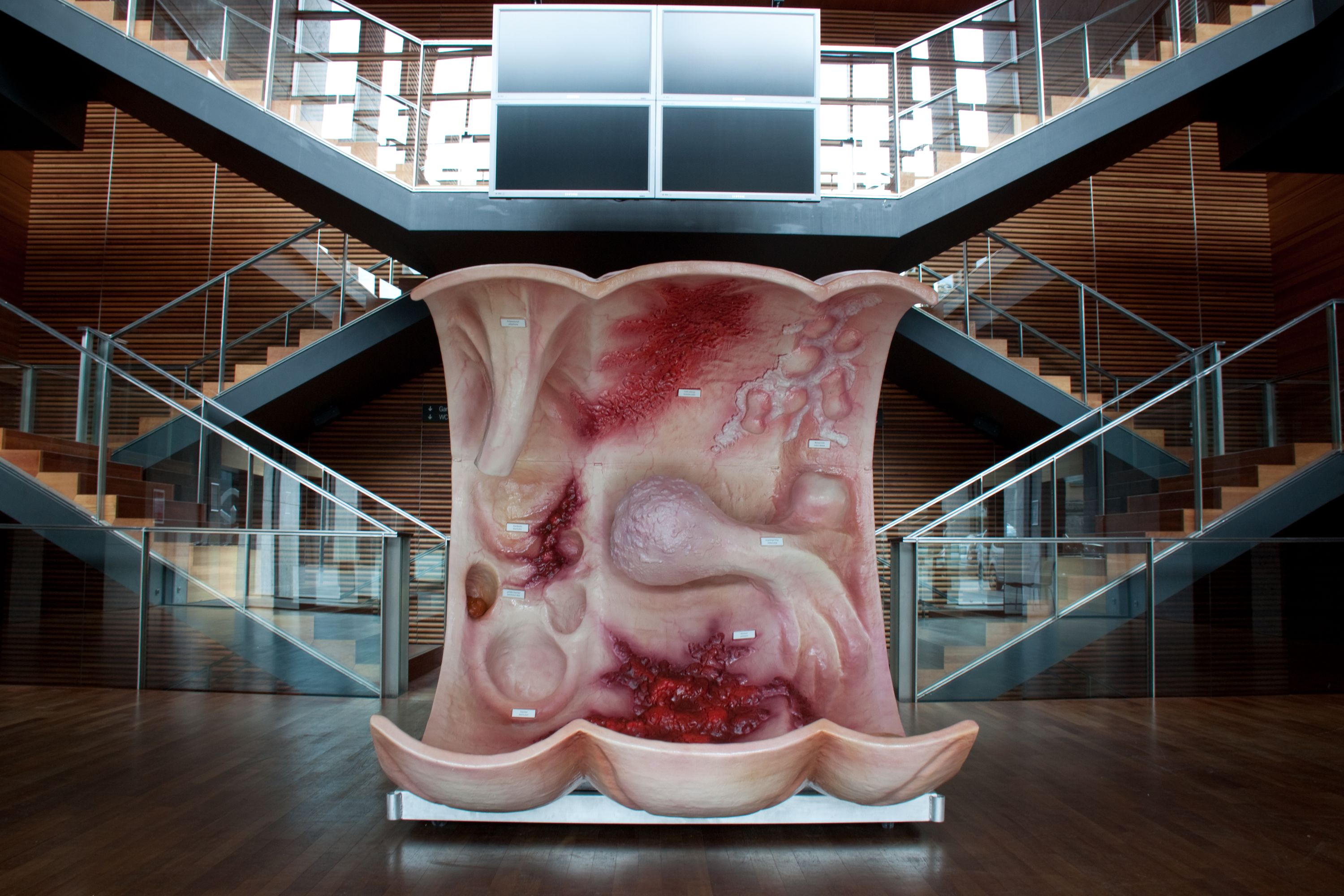 Darmkrebstag am Herzogin Elisabeth Hospital regionalHeute.de