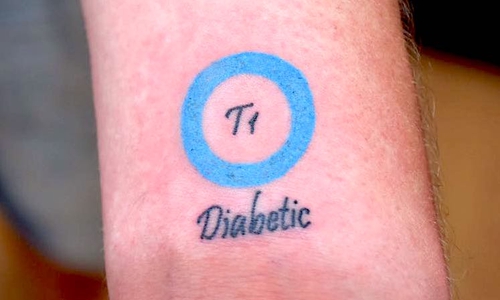So sieht das Diabetes-Tattoo aus. Foto: Privat