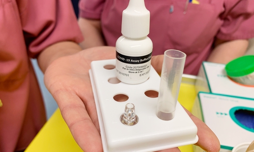 Alle Patienten und Mitarbeitenden des Städtischen Klinikums werden auf das Coronavirus mittels Antigenschnelltest (Foto) bzw. PCR-Test getestet. 