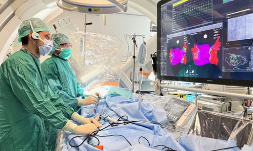 Bei der Behandlung von Herzrhythmusstörungen steht den Spezialisten im Klinikum Wolfsburg mit der Pulsed Field Ablation seit kurzem eine weitere effektive und für den Patienten schonende Therapieoption zur Verfügung.