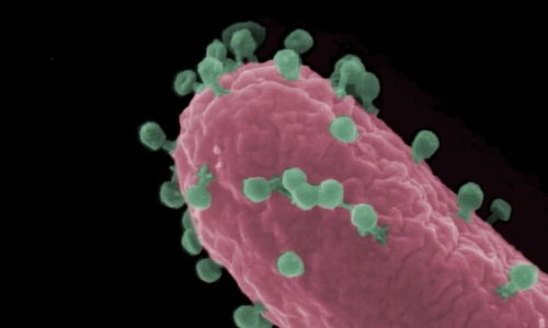 Rasterelektronenmikroskopische Aufnahme einer Escherichia coli-Zelle (rot), die von Bakteriophagen (grün) infiziert wird.