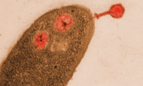 Elektronenmikroskopische Aufnahme von Pseudomonas aeruginosa, infiziert mit dem Jumbophagen ΦKZ (rot).