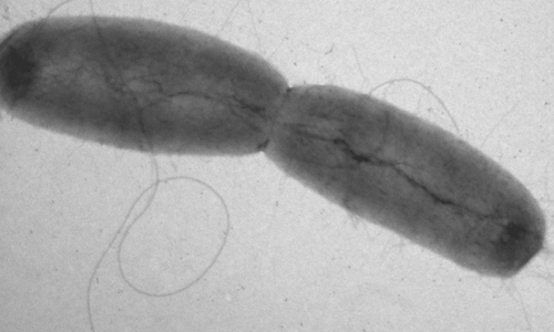 Coli-Bakterien (Archiv)