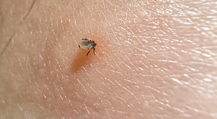 Zecken im Anmarsch: Wie man sich schützt und Infektionsrisiken verringert