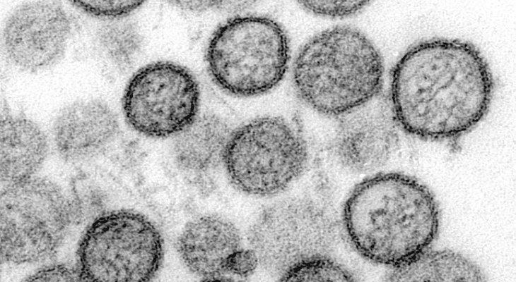 Nach Hantavirus-Ausbruch: Auch in der Region Braunschweig gab es Fälle