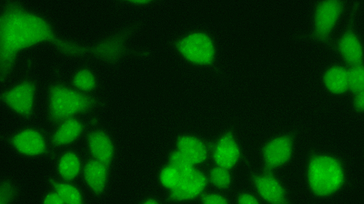 Auf der Suche nach Antworten: Braunschweiger Forscher erforschen das metabolische Syndrom