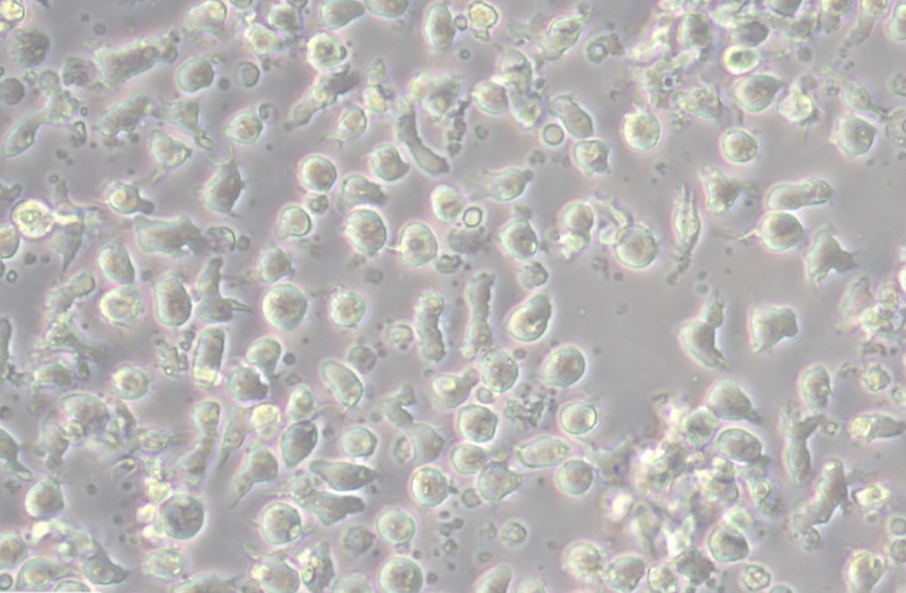 Diese-Rolle-nimmt-ein-Braunschweiger-Institut-im-Kampf-gegen-den-Krebs-ein