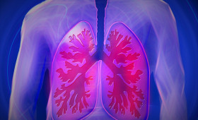 Volkskrankheit COPD: Eine Stadt in der Region besonders betroffen 