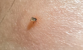 Zecken im Anmarsch: Wie man sich schützt und Infektionsrisiken verringert