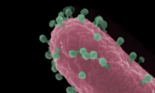 Rasterelektronenmikroskopische Aufnahme einer Escherichia coli-Zelle (rot), die von Bakteriophagen (grün) infiziert wird.