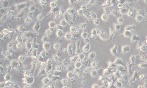 MUTZ-3 ist eine akute myeloische Leukämie Zelllinie.