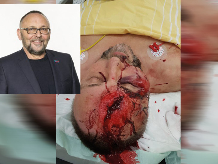Der Bundestagsabgeordnete Frank Magnitz kam schwer verletzt ins Krankenhaus. Fotos: AfD Landesverband Bremen