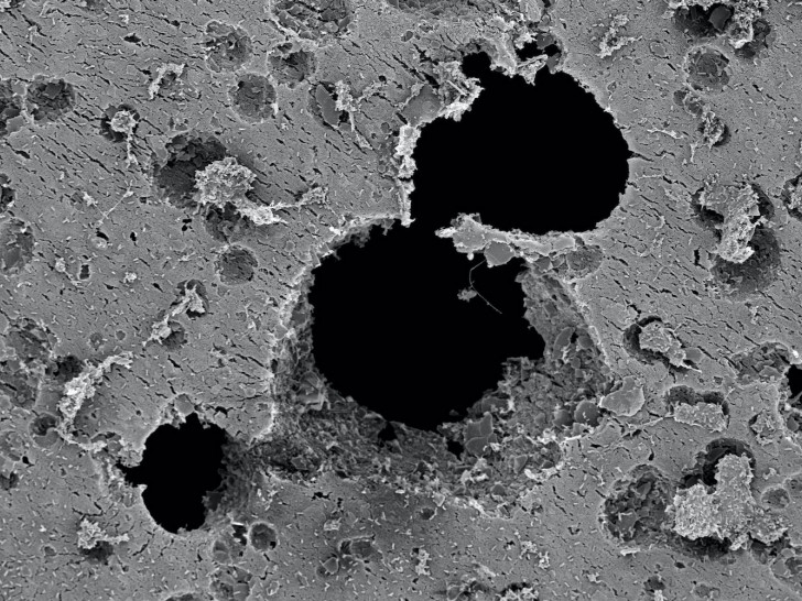 Elektronenmikroskopische Aufnahme von durch bakteriellem Abbau entstandenen Löchern (schwarz) im Plastik.