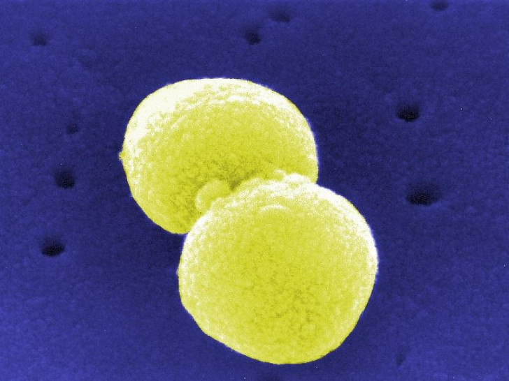 Streptococcus pneumoniae (Archiv)