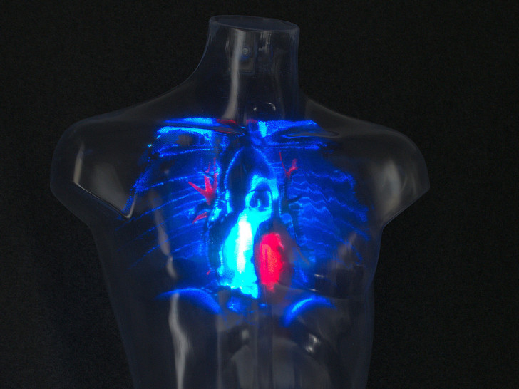 Hingucker auf der Messe wird das durchsichtige Model eines menschlichen Torsos, in den MRT-Bildsequenzen und 3D-Animationen projiziert werden können, um klinische Fragestellungen anschaulich darzustellen. 