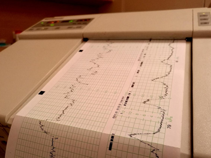 Kardiotokografie im Krankenhaus (Archiv)