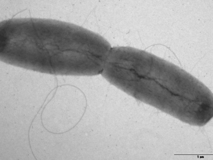 Coli-Bakterien (Archiv)