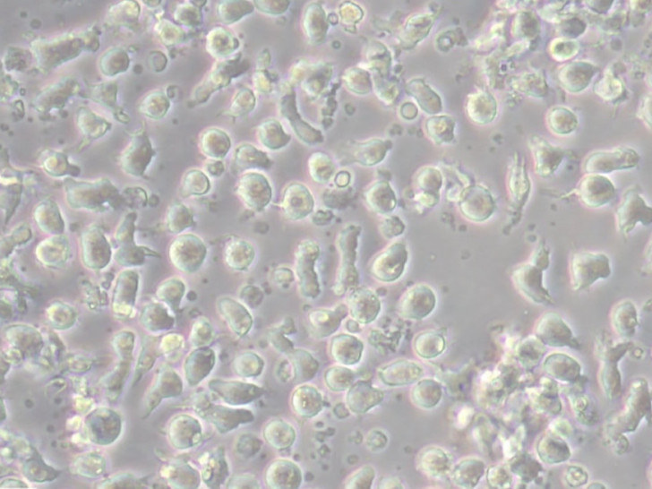 MUTZ-3 ist eine akute myeloische Leukämie Zelllinie.